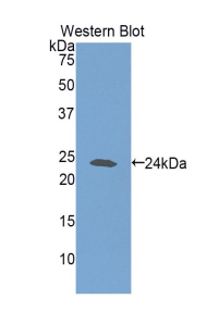 GSS / Glutathione Synthetase Antibody - Western blot of recombinant GSS / Glutathione Synthetase.  This image was taken for the unconjugated form of this product. Other forms have not been tested.