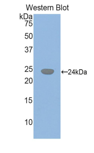 GSS / Glutathione Synthetase Antibody - Western blot of recombinant GSS / Glutathione Synthetase.  This image was taken for the unconjugated form of this product. Other forms have not been tested.