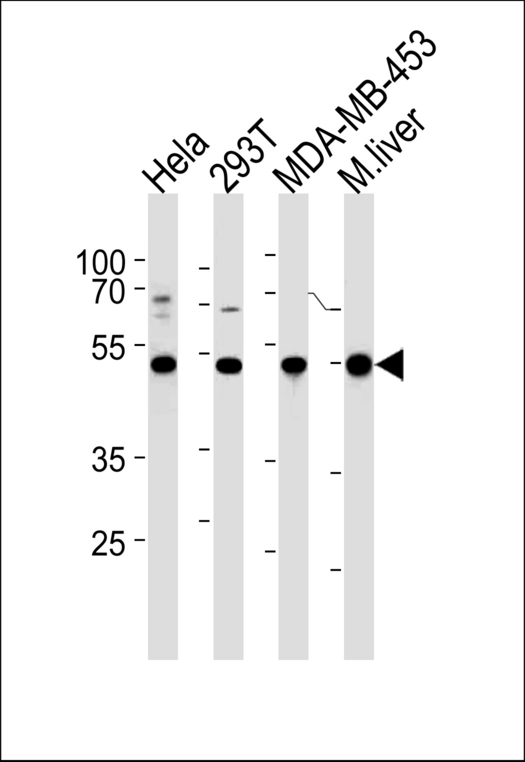 GSS / Glutathione Synthetase Antibody - GSS Antibody western blot of HeLa,293T,MDA-MB-453 cell line and mouse liver tissue lysates (35 ug/lane). The GSS antibody detected the GSS protein (arrow).