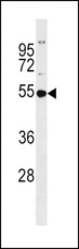 GSS / Glutathione Synthetase Antibody - GSS Antibody western blot of MDA-MB453 cell line lysates (35 ug/lane). The GSS antibody detected the GSS protein (arrow).