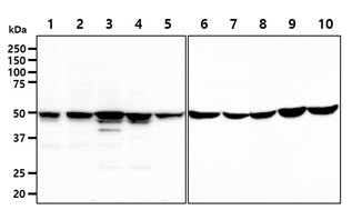 GSS / Glutathione Synthetase Antibody - The cell lysates (40ug) were resolved by SDS-PAGE, transferred to PVDF membrane and probed with anti-human GSS antibody (1:1000). Proteins were visualized using a goat anti-mouse secondary antibody conjugated to HRP and an ECL detection system. Lane 1.: MDA-MB231 cell lysate Lane 2.: WiDr cell lysate Lane 3.: SW480 cell lysate Lane 4.: A427 cell lysate Lane 5.: MCF7 cell lysate Lane 6.: 293T cell lysate Lane 7.: HeLa cell lysate Lane 8.: HT1080 cell lysate Lane 9.: U87MG cell lysate Lane 10.: A549 cell lysate