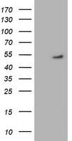 GSS / Glutathione Synthetase Antibody - HEK293T cells were transfected with the pCMV6-ENTRY control (Left lane) or pCMV6-ENTRY GSS (Right lane) cDNA for 48 hrs and lysed. Equivalent amounts of cell lysates (5 ug per lane) were separated by SDS-PAGE and immunoblotted with anti-GSS.