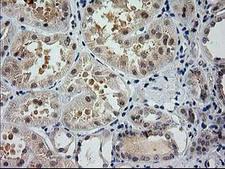 GSS / Glutathione Synthetase Antibody - IHC of paraffin-embedded Human Kidney tissue using anti-GSS mouse monoclonal antibody. (Heat-induced epitope retrieval by 10mM citric buffer, pH6.0, 100C for 10min).
