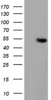 GSS / Glutathione Synthetase Antibody - HEK293T cells were transfected with the pCMV6-ENTRY control (Left lane) or pCMV6-ENTRY GSS (Right lane) cDNA for 48 hrs and lysed. Equivalent amounts of cell lysates (5 ug per lane) were separated by SDS-PAGE and immunoblotted with anti-GSS.