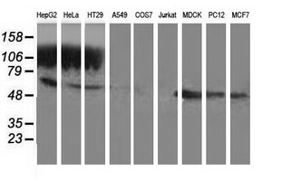 GSS / Glutathione Synthetase Antibody - Western blot of extracts (35 ug) from 9 different cell lines by using anti-GSS monoclonal antibody.