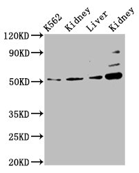 GSS / Glutathione Synthetase Antibody - Positive Western Blot detected in K562 whole cell lysate, Rat kidney tissue, Mouse liver tissue, Mouse kidney tissue. All lanes: GSS antibody at 5.1 µg/ml Secondary Goat polyclonal to rabbit IgG at 1/50000 dilution. Predicted band size: 53, 41 KDa. Observed band size: 53 KDa