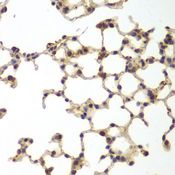 GSS / Glutathione Synthetase Antibody - Immunohistochemistry of paraffin-embedded mouse lung using GSS antibody at dilution of 1:200 (40x lens).