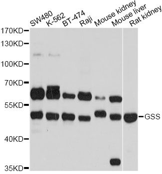 GSS / Glutathione Synthetase Antibody - Western blot analysis of extracts of various cell lines, using GSS antibody at 1:1000 dilution. The secondary antibody used was an HRP Goat Anti-Rabbit IgG (H+L) at 1:10000 dilution. Lysates were loaded 25ug per lane and 3% nonfat dry milk in TBST was used for blocking. An ECL Kit was used for detection and the exposure time was 1s.