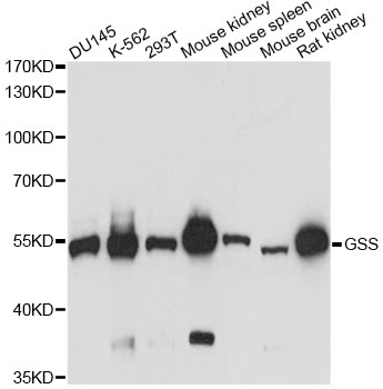 GSS / Glutathione Synthetase Antibody - Western blot analysis of extracts of various cell lines, using GSS antibody at 1:3000 dilution. The secondary antibody used was an HRP Goat Anti-Rabbit IgG (H+L) at 1:10000 dilution. Lysates were loaded 25ug per lane and 3% nonfat dry milk in TBST was used for blocking. An ECL Kit was used for detection and the exposure time was 3s.