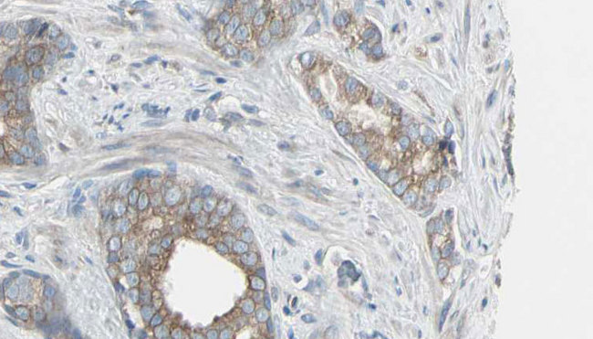 GSS / Glutathione Synthetase Antibody - 1:100 staining human prostate tissue by IHC-P. The sample was formaldehyde fixed and a heat mediated antigen retrieval step in citrate buffer was performed. The sample was then blocked and incubated with the antibody for 1.5 hours at 22°C. An HRP conjugated goat anti-rabbit antibody was used as the secondary.