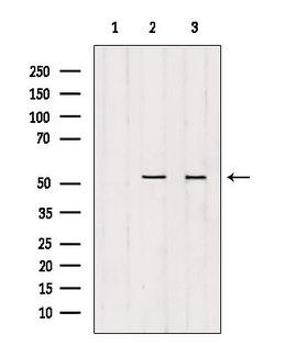 GSS / Glutathione Synthetase Antibody - Western blot analysis of extracts of various samples using GSS antibody. Lane 1: HepG2 treated with blocking peptide. Lane 2: HepG2; Lane 3: mouse Myeloma cells;