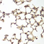 GSS / Glutathione Synthetase Antibody - Immunohistochemistry of paraffin-embedded Mouse lung using GSS Polyclonal Antibody at dilution of 1:200 (40x lens).