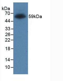 GST / Glutathione S-Transferase Antibody