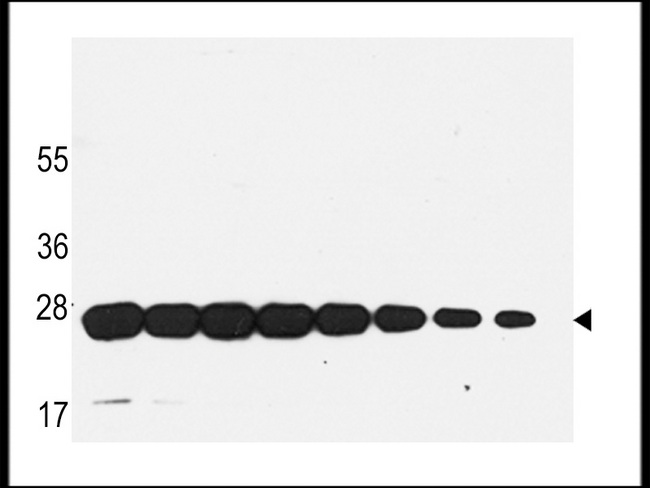 GST / Glutathione S-Transferase Antibody - Western blot of anti-GST antibody in recombinant GST protein. GST(arrow) was detected using the purified antibody.