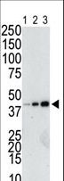 GST Tag Antibody - The anti-GST antibody is used in Western blot to detect a GST-fusion recombinant protein (42 kDa) purified from bacterial lysate (Lanes 1-3: 10, 40, and 160 ng GST-fusion protein).