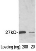 GST Tag Antibody - Western blot of GST fusion protein using 1 ug/ml Rabbit Anti-GST-tag Polyclonal Antibody GST-tag Antibody, pAb, Rabbit The result was developed with One-Step Western Basic Kit (Rabbit)