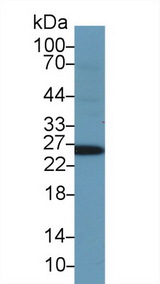 GSTA1 Antibody - Western Blot; Sample: Human Serum; Primary Ab: 2µg/ml Rabbit Anti-Human GSTa1 Antibody Second Ab: 0.2µg/mL HRP-Linked Caprine Anti-Rabbit IgG Polyclonal Antibody