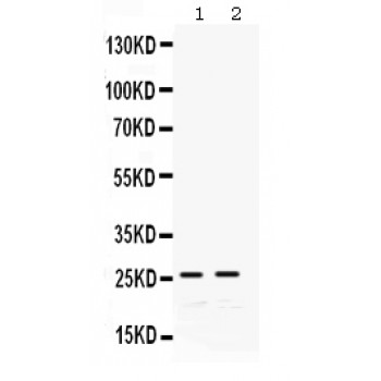 GSTA1 Antibody - GSTA1/A2/A3/A4/A5 antibody Western blot. All lanes: Anti GSTA1/A2/A3/A4/A5 at 0.5 ug/ml. Lane 1: Rat Liver Tissue Lysate at 50 ug. Lane 2: Mouse Liver Tissue Lysate at 50 ug. Predicted band size: 26 kD. Observed band size: 26 kD.