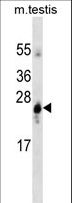 GSTA1 Antibody - GSTA1 western blot of mouse testis tissue lysates (35 ug/lane). The GSTA1 antibody detected the GSTA1 protein (arrow).
