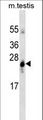GSTA1 Antibody - GSTA1 western blot of mouse testis tissue lysates (35 ug/lane). The GSTA1 antibody detected the GSTA1 protein (arrow).