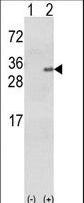 GSTA1 Antibody - Western blot of GSTA1 (arrow) using rabbit polyclonal GSTA1 Antibody. 293 cell lysates (2 ug/lane) either nontransfected (Lane 1) or transiently transfected with the GSTA1 gene (Lane 2).