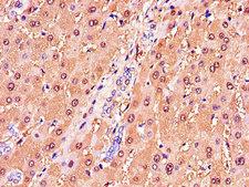 GSTA1 Antibody - Immunohistochemistry of paraffin-embedded human liver tissue using GSTA1 Antibody at dilution of 1:100