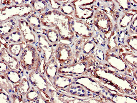 GSTA1 Antibody - Immunohistochemistry of paraffin-embedded human kidney tissue using GSTA1 Antibody at dilution of 1:100