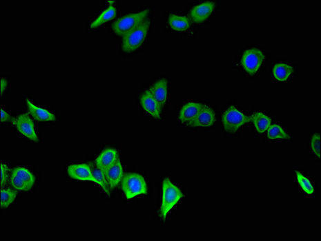 GSTA1 Antibody - Immunofluorescent analysis of HepG2 cells using GSTA1 Antibody at a dilution of 1:100 and Alexa Fluor 488-congugated AffiniPure Goat Anti-Rabbit IgG(H+L)