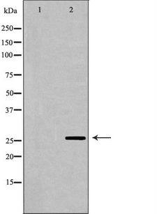 GSTA1 Antibody - Western blot analysis of extracts of mouse liver tissue using GSTA1 antibody. The lane on the left is treated with the antigen-specific peptide.