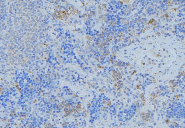 GSTA1 Antibody - 1:100 staining human lymph node tissue by IHC-P. The sample was formaldehyde fixed and a heat mediated antigen retrieval step in citrate buffer was performed. The sample was then blocked and incubated with the antibody for 1.5 hours at 22°C. An HRP conjugated goat anti-rabbit antibody was used as the secondary.