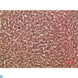 GSTA1 Antibody - Immunohistochemical analysis of paraffin-embedded human-liver, antibody was diluted at 1:200.