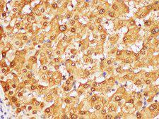 GSTA1 Antibody - Immunohistochemistry of paraffin-embedded Human liver using GSTA1 Polycloanl Antibody at dilution of 1:50.