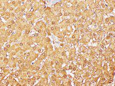 GSTA1 Antibody - Immunohistochemistry of paraffin-embedded Human liver using GSTA1 Polycloanl Antibody at dilution of 1:200.