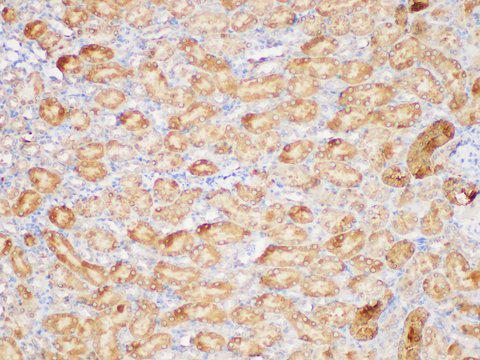 GSTA1 Antibody - Immunohistochemistry of paraffin-embedded Mouse kidney using GSTA1 Polycloanl Antibody at dilution of 1:200.