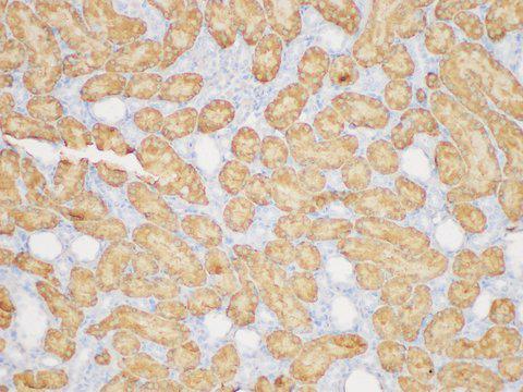 GSTA1 Antibody - Immunohistochemistry of paraffin-embedded Rat kidney using GSTA1 Polycloanl Antibody at dilution of 1:200.
