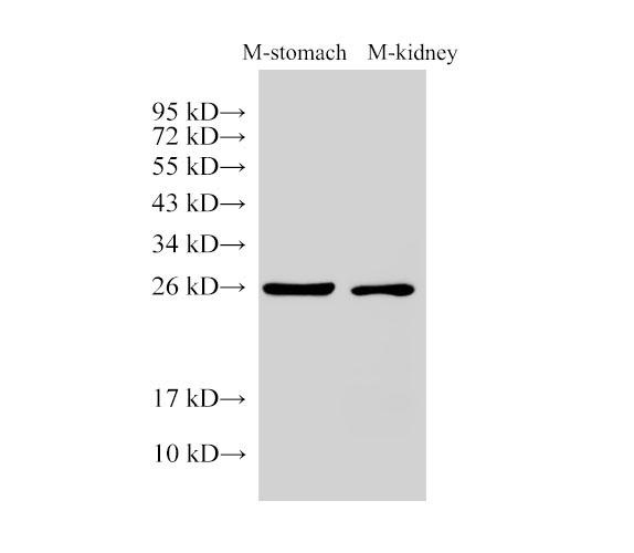 GSTA1 Antibody - Western Blot analysis of Mouse stomach and Mouse kidney using GSTA1 Polyclonal Antibody at dilution of 1:3000.