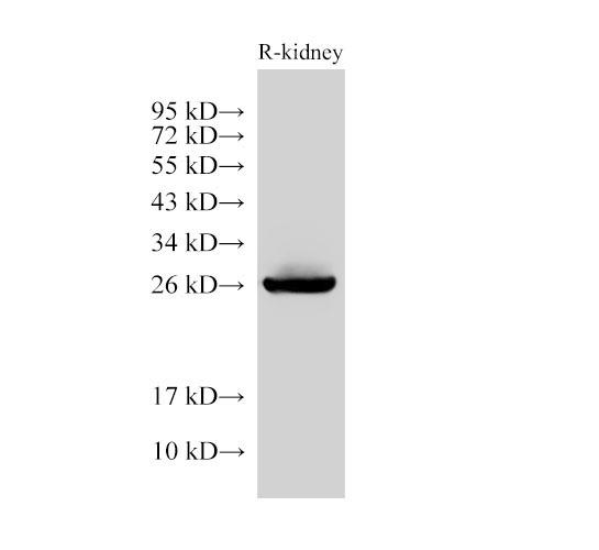GSTA1 Antibody - Western Blot analysis of Rat kidney using GSTA1 Polyclonal Antibody at dilution of 1:6000.