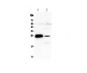 GSTA1+GSTA2+GSTA3+GSTA4+GSTA5 Antibody - Western blot analysis of GSTA1/A2/A3/A4/A5 using anti-GSTA1/A2/A3/A4/A5 antibody