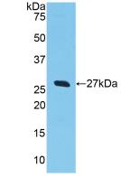 GSTA2 Antibody
