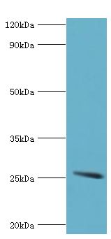 GSTA2 Antibody - Western blot. All lanes: Glutathione S-transferase A2 antibody at 4 ug/ml+mouse liver tissue. Secondary antibody: Goat polyclonal to rabbit at 1:10000 dilution. Predicted band size: 26 kDa. Observed band size: 26 kDa Immunohistochemistry.