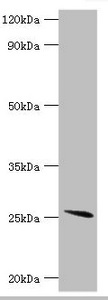 GSTA2 Antibody - Western blot All lanes: Glutathione S-transferase A2 antibody at 4µg/ml + Mouse liver tissue Secondary Goat polyclonal to rabbit IgG at 1/10000 dilution Predicted band size: 26 kDa Observed band size: 26 kDa