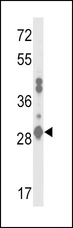 GSTA2 Antibody - Western blot of GSTA2 Antibody in MDA-MB231 cell line lysates (35 ug/lane). GSTA2 (arrow) was detected using the purified antibody.