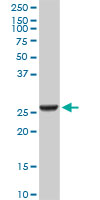 GSTA2 Antibody - GSTA2 monoclonal antibody (M05), clone 3D4. Western Blot analysis of GSTA2 expression in human liver.