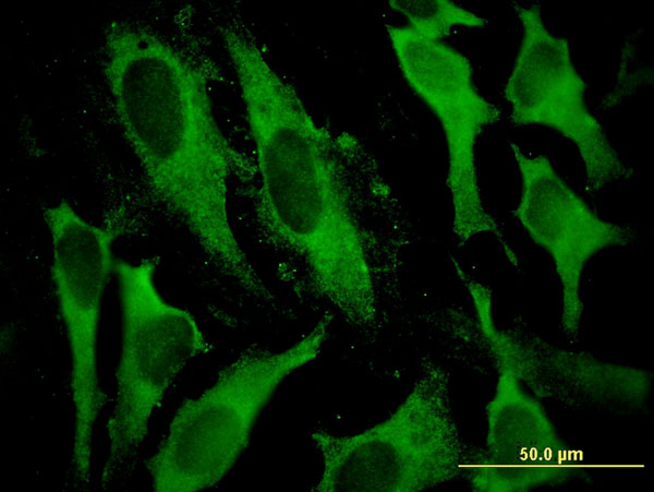 GSTA2 Antibody - Immunofluorescence of monoclonal antibody to GSTA2 on HeLa cell . [antibody concentration 10 ug/ml]