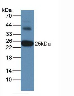 GSTA3 Antibody - Western Blot Human Liver Tissue Primary Ab: 2µg/mL Rabbit Anti-Human GSTa3 Ab Second Ab: 1:5000 Dilution of HRP-Linked Rabbit Anti-Mouse IgG Ab