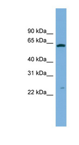 GSTA3 Antibody - GSTA3 antibody Western blot of HCT15 cell lysate. This image was taken for the unconjugated form of this product. Other forms have not been tested.