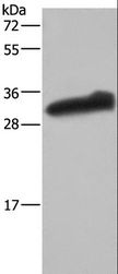 GSTA3 Antibody - Western blot analysis of Human testis tissue, using GSTA3 Polyclonal Antibody at dilution of 1:250.
