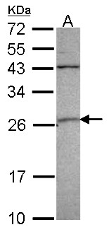 GSTA4 Antibody - Sample (30 ug of whole cell lysate). A:293T. 12% SDS PAGE. GST A4 antibody. GSTA4 antibody diluted at 1:1000.