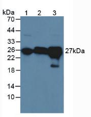 GSTA4 Antibody - Western Blot; Sample: Lane1: Rat Serum; Lane2: Rat Brain Tissue; Lane3: Rat Liver Tissue.