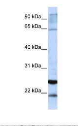 GSTA4 Antibody - Jurkat cell lysate. Antibody concentration: 1.0 ug/ml. Gel concentration: 12%.  This image was taken for the unconjugated form of this product. Other forms have not been tested.